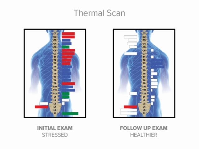 Scan Technology Helps Chiropractic Patients Measure Success