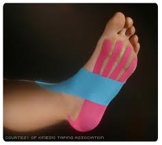 Adirondack Physical and Occupational Therapy offers new treatment technique, kinesiotaping