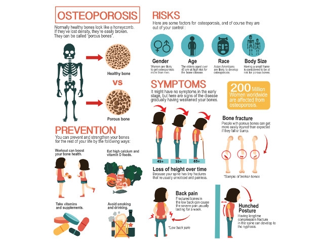 Next Free Bone Density Screening June 25 in Mexico