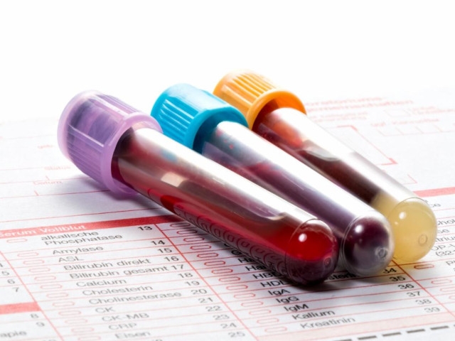 Multi-Organ Blood Analysis During September
